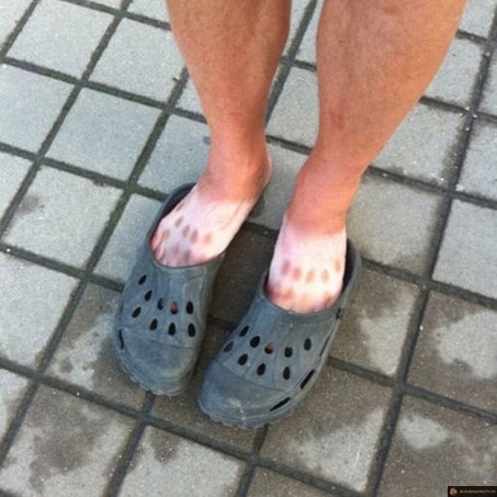 L'été et les crocs