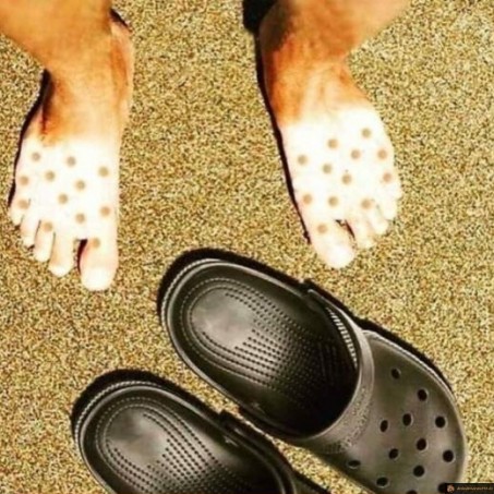 Le bronzage des Crocs