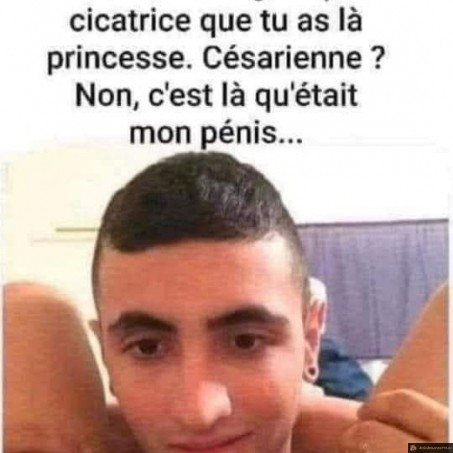 Magnifique cicatrice
