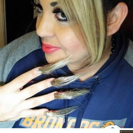 Ongles touffus