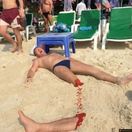 Perdre sa jambe à la plage
